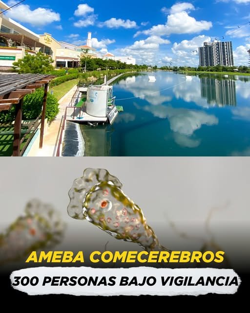 Ameba comecerebros: 300 personas bajo vigilancia